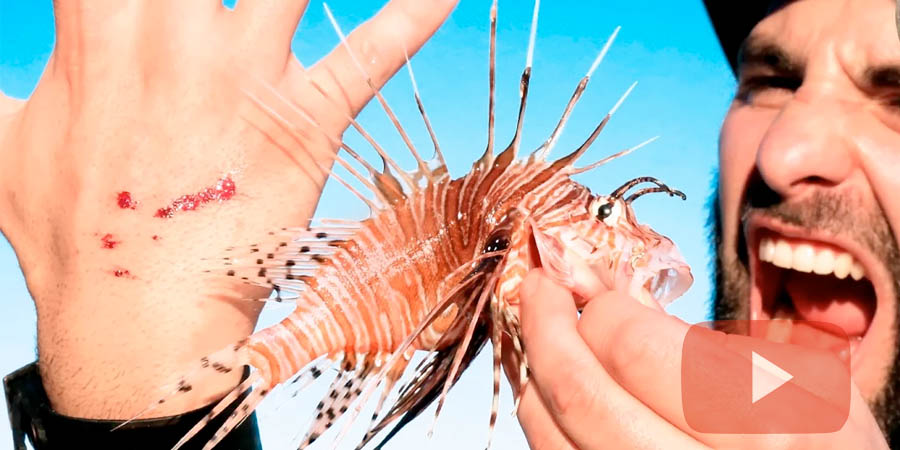 Lion Fish are Invading The Coast of the US.  This is what a Lion Fish Sting Looks Like (WARNING GRAPHIC)